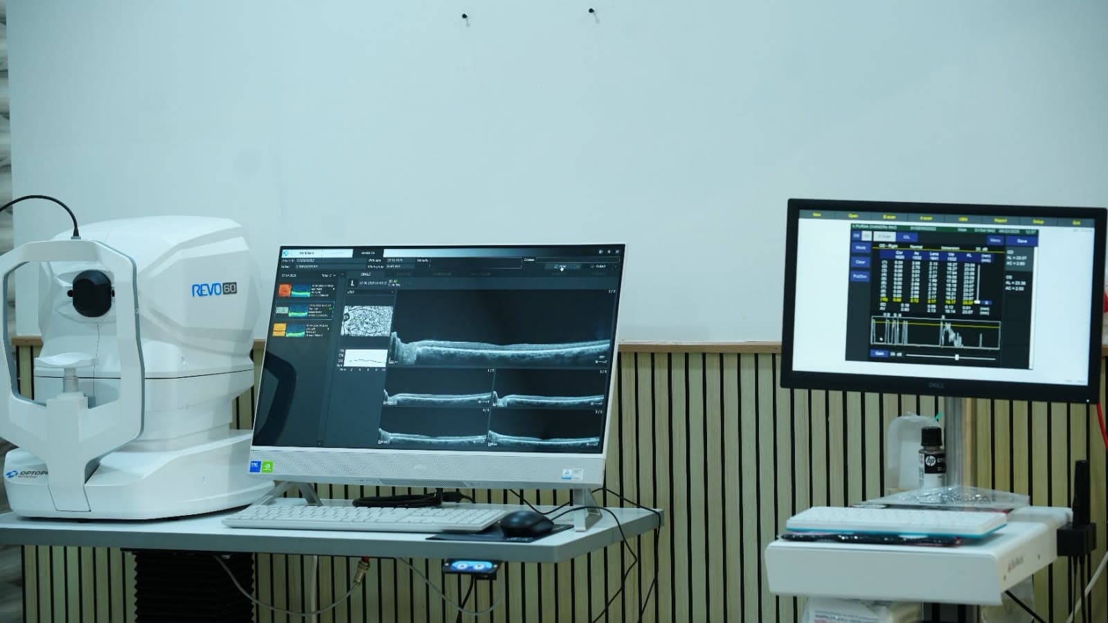Ophthalmic equipment at Safe Vision Eye Hospital